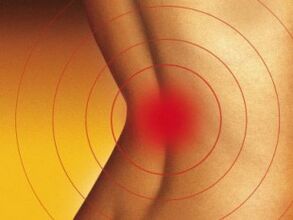 Bolesť v dolnej časti chrbta s osteochondrózou